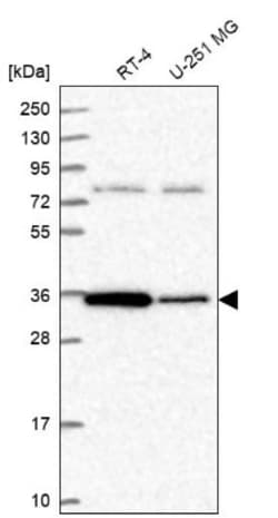 SC35 Antibody, Novus Biologicals 0.1 mL | Buy Online | Novus Biologicals | Fisher Scientific